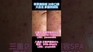 南港站 在寶麗萊美容SPA，我們的無痛清粉刺服務讓您在放鬆中感受自然的清新感。專業技術與溫馨環境相結合，每次都讓您在輕鬆的過程中展現自信的美麗。