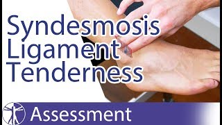 Syndesmosis Ligament Tenderness Palpation | Syndesmosis Injury