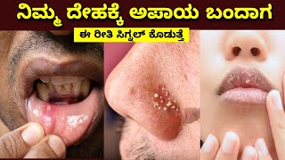 vitamin deficiency symptoms in Kannada