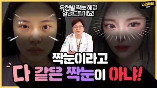 눈 한쪽만 쌍수를 한다고? 짝눈에도 종류가 있다! 짝눈이라고 다 같은 짝눈이 아닌 이유는? - 닥터 노경환