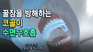 코골이 환자 치료_구강내장치 - 안녕히 주무세요, 꿀잠의 조건 (KBS_751회_2020.10.28 방송)