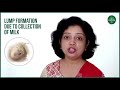 what is breast mastitis breast infection how can i tell if i have mastitis dr nihar parekh