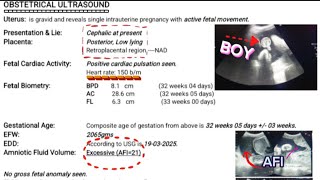 Pregnancy Scan Report At 32 Weeks 5 Days | Posterior Placenta (Boy/Girl?) | FHR 150 | AFI 21