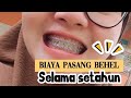 SETAHUN PAKAI BEHEL LANGSUNG RAPI / BIAYA PASANG BEHEL DI DOKTER SPC ORTHO