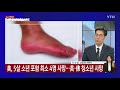 경기 부천 돌잔치 감염 확산...신규 확진자 23명 ytn