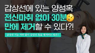 갑상선에 혹이 있으신가요? 마취없이 30분만에 없애는 법은!