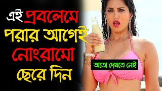 সময় থাকতেই ওসব ছেরে নিজেকে বাঁচান | SUCCESS NEVER END HEALTH TIPS BANGLA