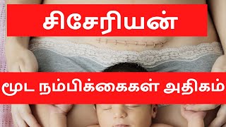 சிசேரியன் பிரசவங்களும் மூட நம்பிக்கைகளும்|STRONGTEA