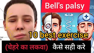 Facial palsy 10 best exercise