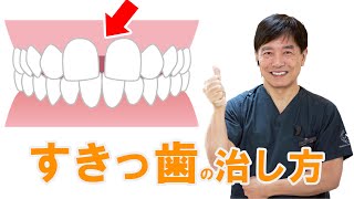 すきっ歯　前歯のすき間を治す方法　前歯のすき間は金運や運勢にも影響する？【岡山の歯医者が解説】