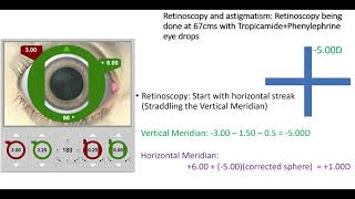 Retinoscopy part 2 Dr Zain Khatib