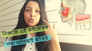 গৰ্ভাৱস্থাত এই ভুল কাম নকৰিব | Pregnancy সময়ত দাঁত আৰু দাঁতৰ আলুৰ যত্ন || Dental \u0026 Gum pain Care