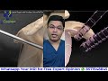 क्या कंधा उतरने का इलाज बिना सर्जरी के हो सकता है shoulder dislocation treatment without surgery