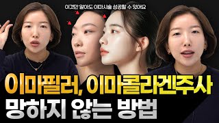 이마 유형별 이마필러, 이마콜라겐주사 망하지 않는 방법. 내 이마는 과연..