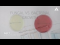 Fungal vs  Bacterial Growth