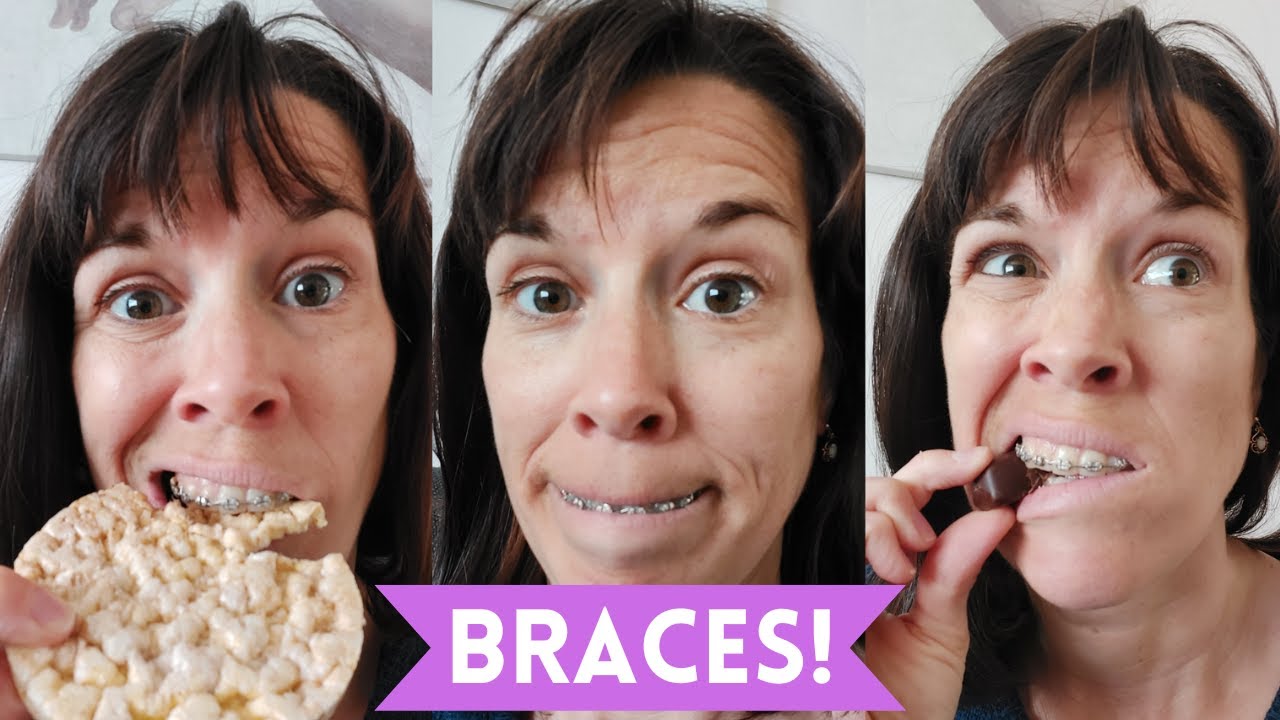 Braces Youtube