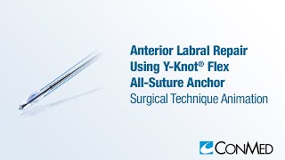 Anterior Labral Repair Using the Y-Knot® Flex - CONMED Animation