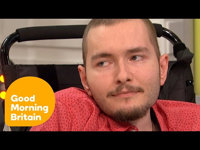 Worlds First Head Transplant Human Head Transplant Sergio Canavero S