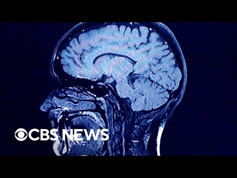 Can explain why one person dies from a disease and another person survives?
