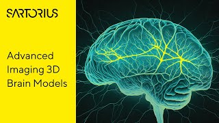 Webinar (Teaser): Modelling Neurodegenerative Disorders in 3D Models