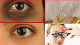 improve eyesight without glasses remove dark circles puffiness on eyes in 1 week