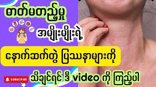 ဓါတ်မတည့်မှု အမျိုးမျိုးရဲ့  နောက်ဆက်တွဲ ပြဿနာများ