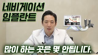 네비게이션 임플란트 많이 해본 곳은 몇 안된다는 사실+어떤분에게 좋을까