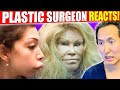 Plastic Surgeon Reacts to WORST Celebrity Surgery DISASTERS!