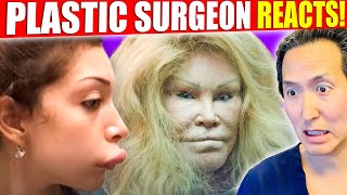 Plastic Surgeon Reacts to WORST Celebrity Surgery DISASTERS!