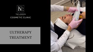 Ultherapy Treatment By Dr Salinda Johnson - The London Cosmetic Clinic