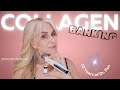 What I've Learned In 10 Years Of Collagen Induction Therapy!