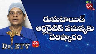 రుమటాయిడ్ ఆర్థరైటిస్ సమస్యకు పరిష్కారం  | డాక్టర్ ఈటీవీ  | 22nd  ఏప్రిల్ 2022 | ఈటీవీ  లైఫ్