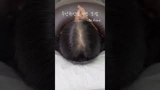 인생네컷 찍을때마다 비어보이는 가르마 #두피문신 #두피문신수강 #hair #탈모 #탈모커버 #인생네컷