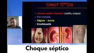 📎 Choque séptico: definición y fisiopatología