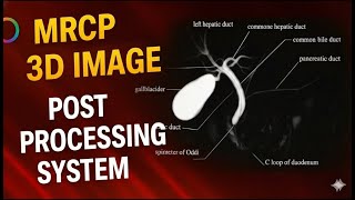 How to Do MRCP 3D Post Processing | Step-by-Step Radiology Guide