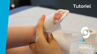 Tutoriel : soins quotidiens à réaliser sur un pied bot