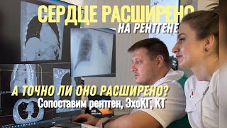 Сердце расширено на рентгене. Кардиомегалия. Точно ли оно расширено?