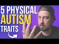 How to Identify AUTISM Easily! (5 SIMPLE PHYSICAL SIGNS)