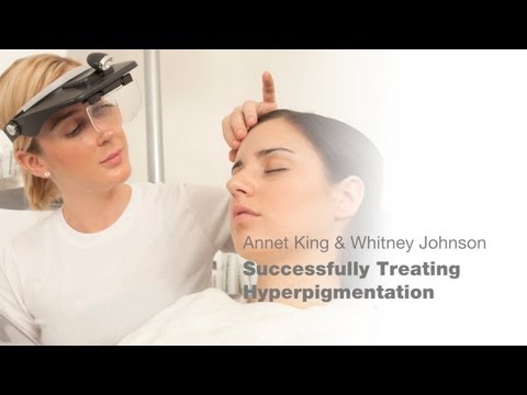 Successfully Treating Hyperpigmentation Youtube