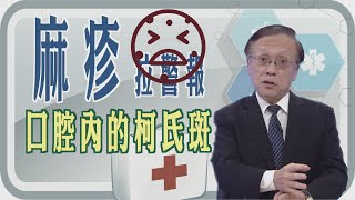 【麻疹拉警報 😱 口腔內的柯氏斑👅👄】【大愛醫生館精選】