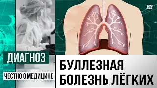 Что такое буллезная эмфизема лёгких и как не умереть от обычного кашля? | Диагноз