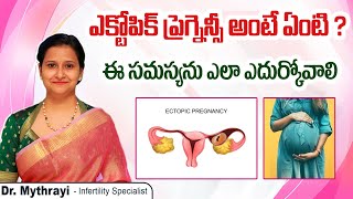 ఎక్టోపిక్ ప్రెగ్నెన్సీ || What an Ectopic Pregnancy \u0026 How to Deal With It? || Mythri Sri Fertility