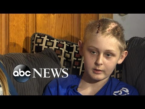 How are coma patients kept alive?