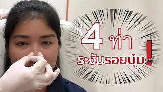 4 ท่า สอนนวดจมูกบุ๋ม (หลังถอดซิลิโคน)