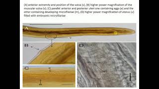 Subcutaneous filariasis