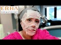 Erha Dermatology : Info Harga Tindakan Laser Picosure