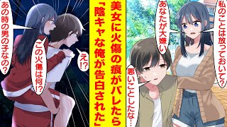 【漫画】6年前に少女を助けて首に火傷の痕が残った俺。クールで有名な学校一の美少女に「この首の火傷って…！？」とバレたら、なぜか俺の世話を焼くようになった。まさか彼女の正体は…！？【恋愛漫画】