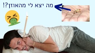 איך לנקות את האוזניים לעומק? ניסיתי נרות הופי לטיפול וניקוי האוזניים - חייבים לראות מה יצא משם!