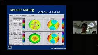 Dr Sean Da Silva - Current Indications \u0026 scope of Posterior Chamber PHAKIC IOLs