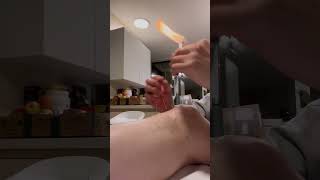 #acupuncture #fire needle #贺氏针灸